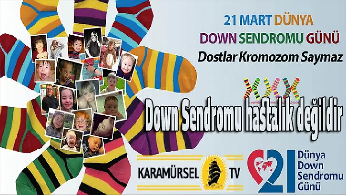 Down Sendromu hastalık değildir!