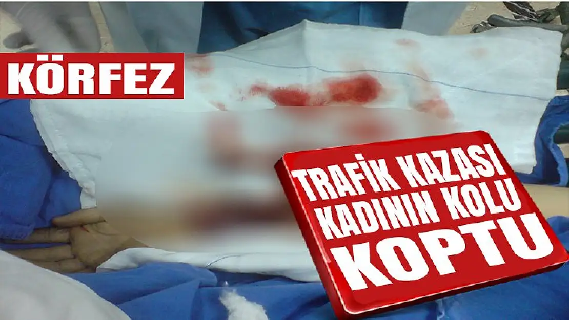 Talihsiz kadının trafik kazasında kolu koptu!