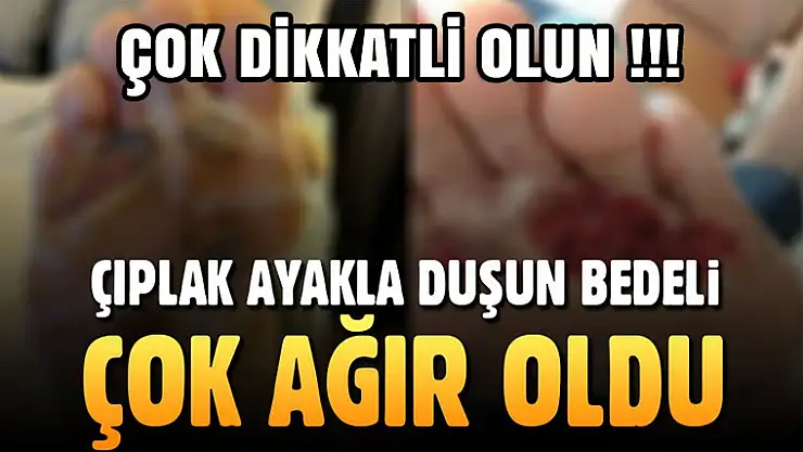 Çıplak ayakla aldığı duş başına bela oldu